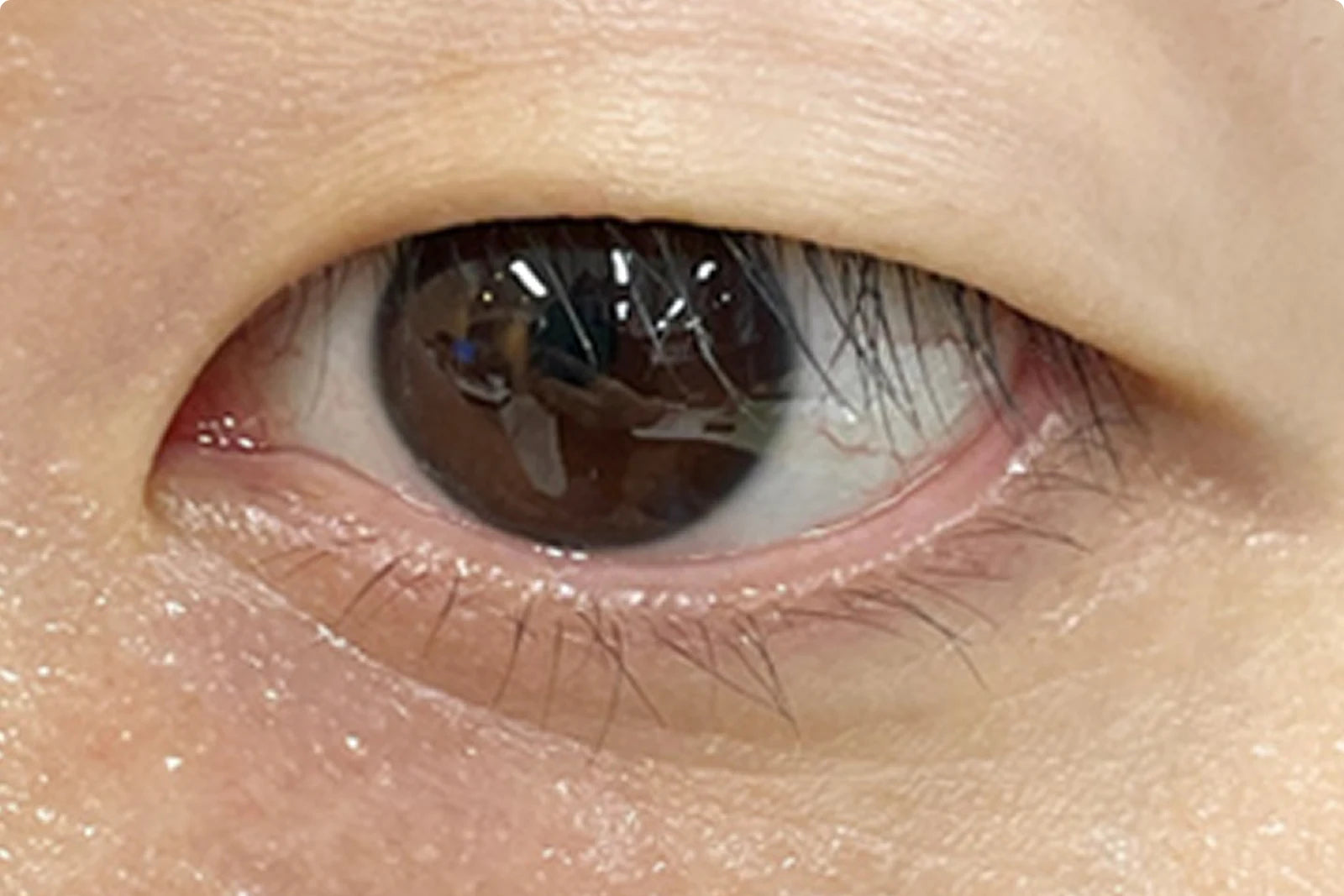 Contour des yeux après utilisation