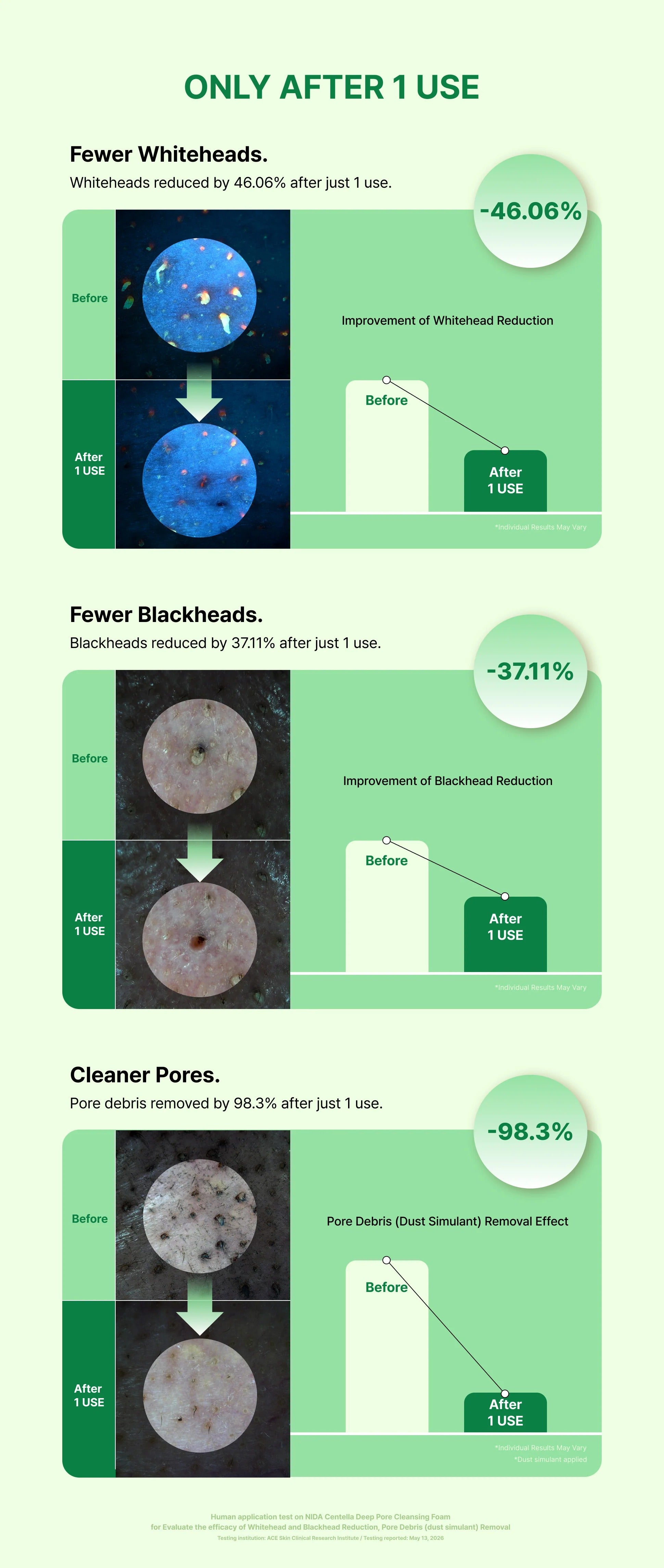 NIDA Centella Deep Pore Cleansing Foam
