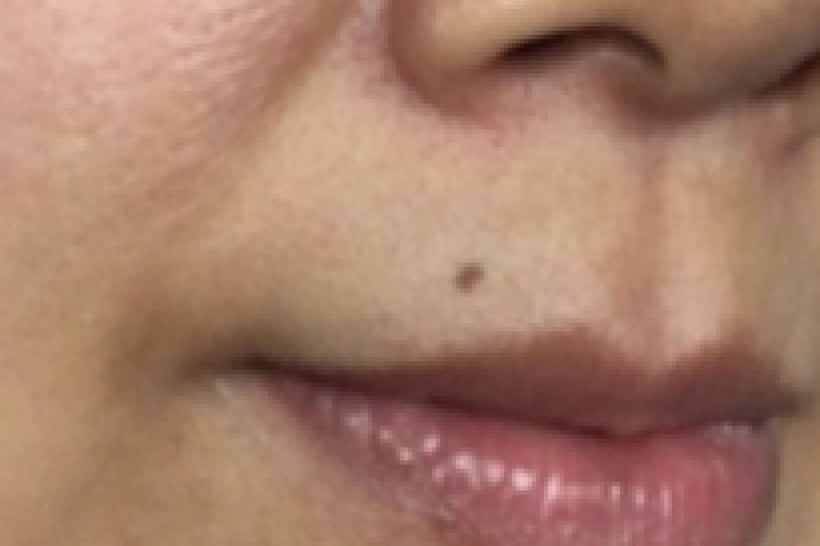 Peau avant utilisation
