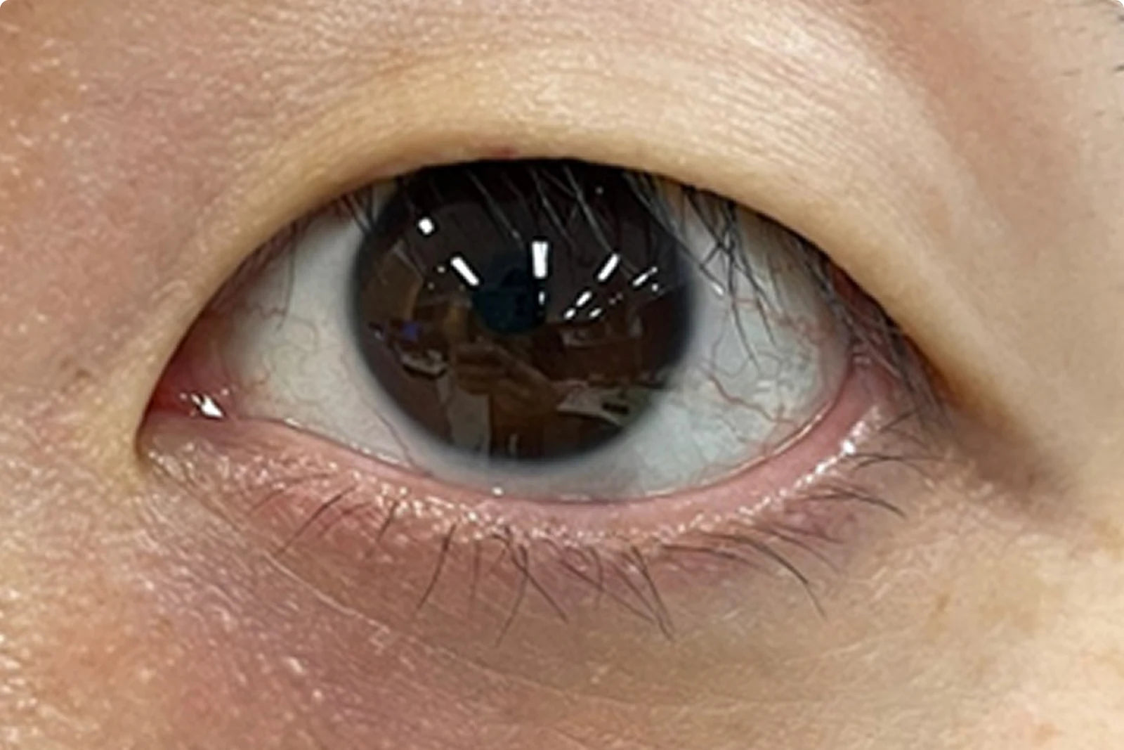 Contour des yeux avant utilisation