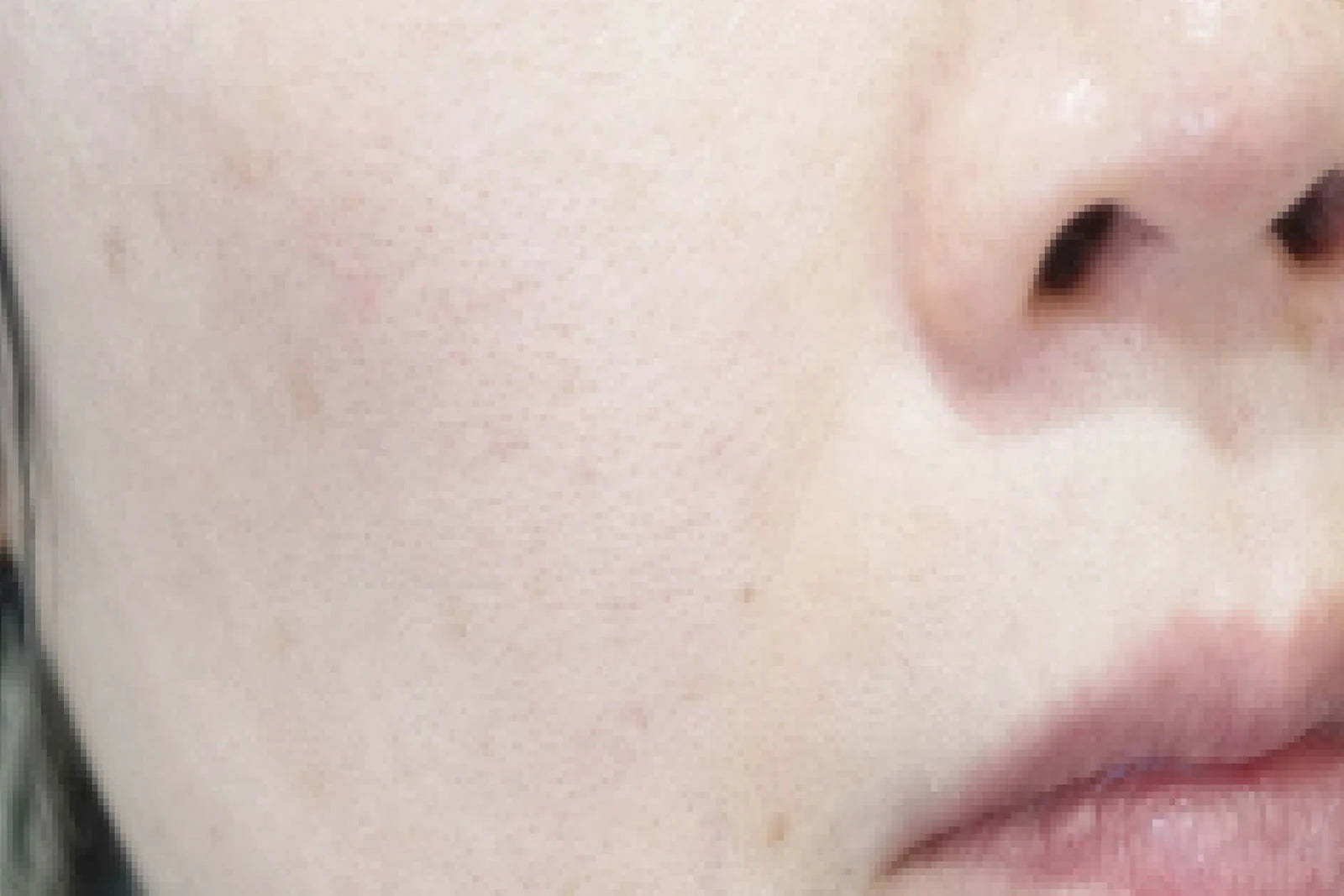 Peau avant utilisation